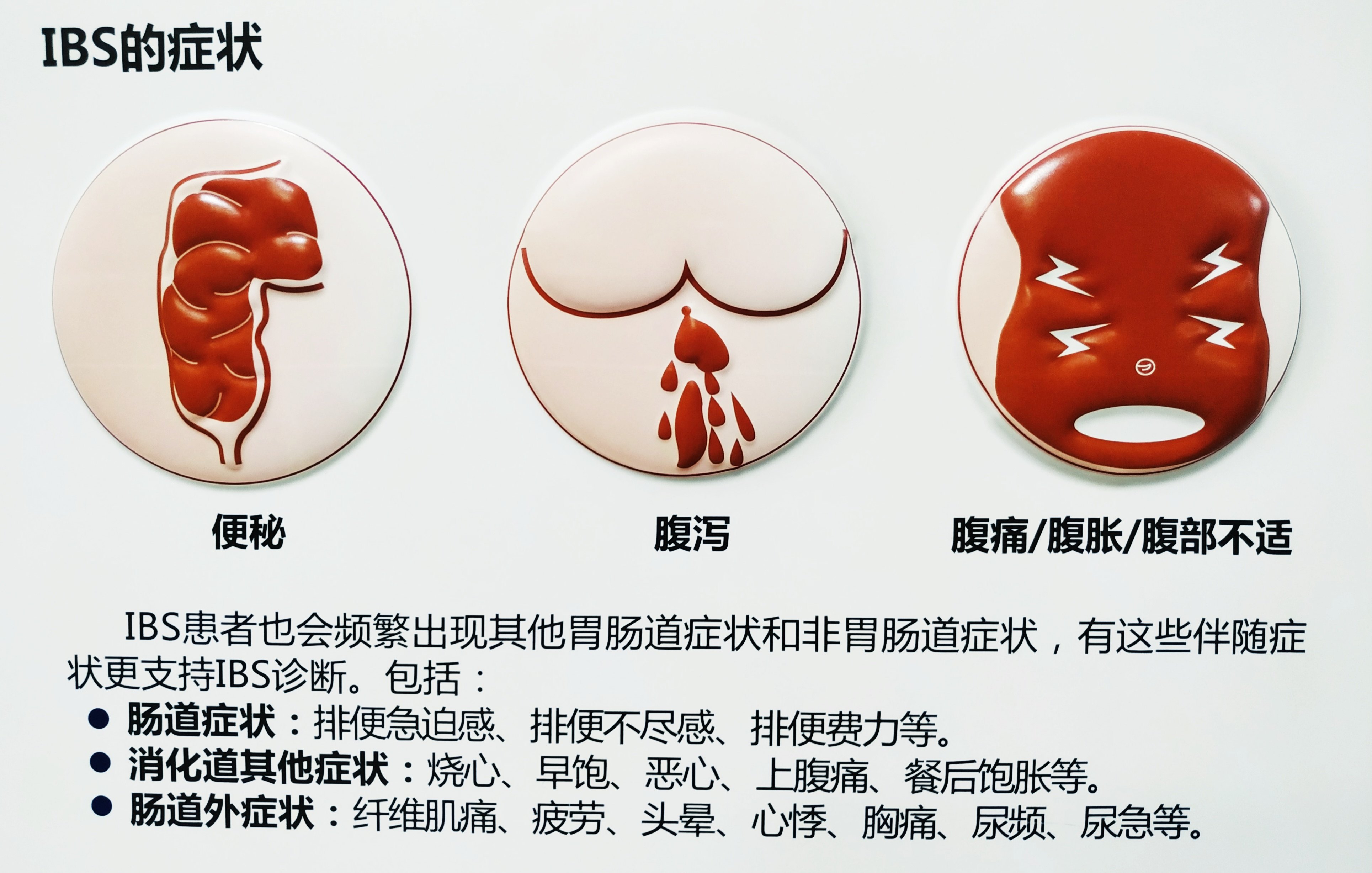 肠易激惹综合征(IBS)~病因篇_肠易激综合征_发病原因_症状表现- 好大夫在线